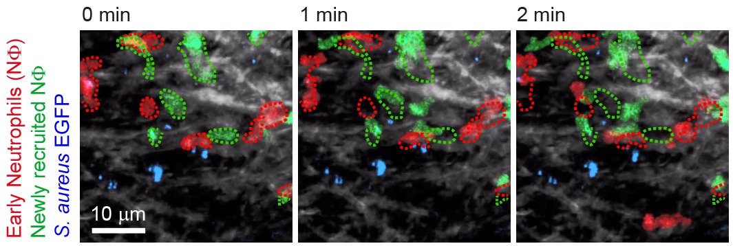 Abbildung Thema Myeloide Abbildung Thema Myeloide